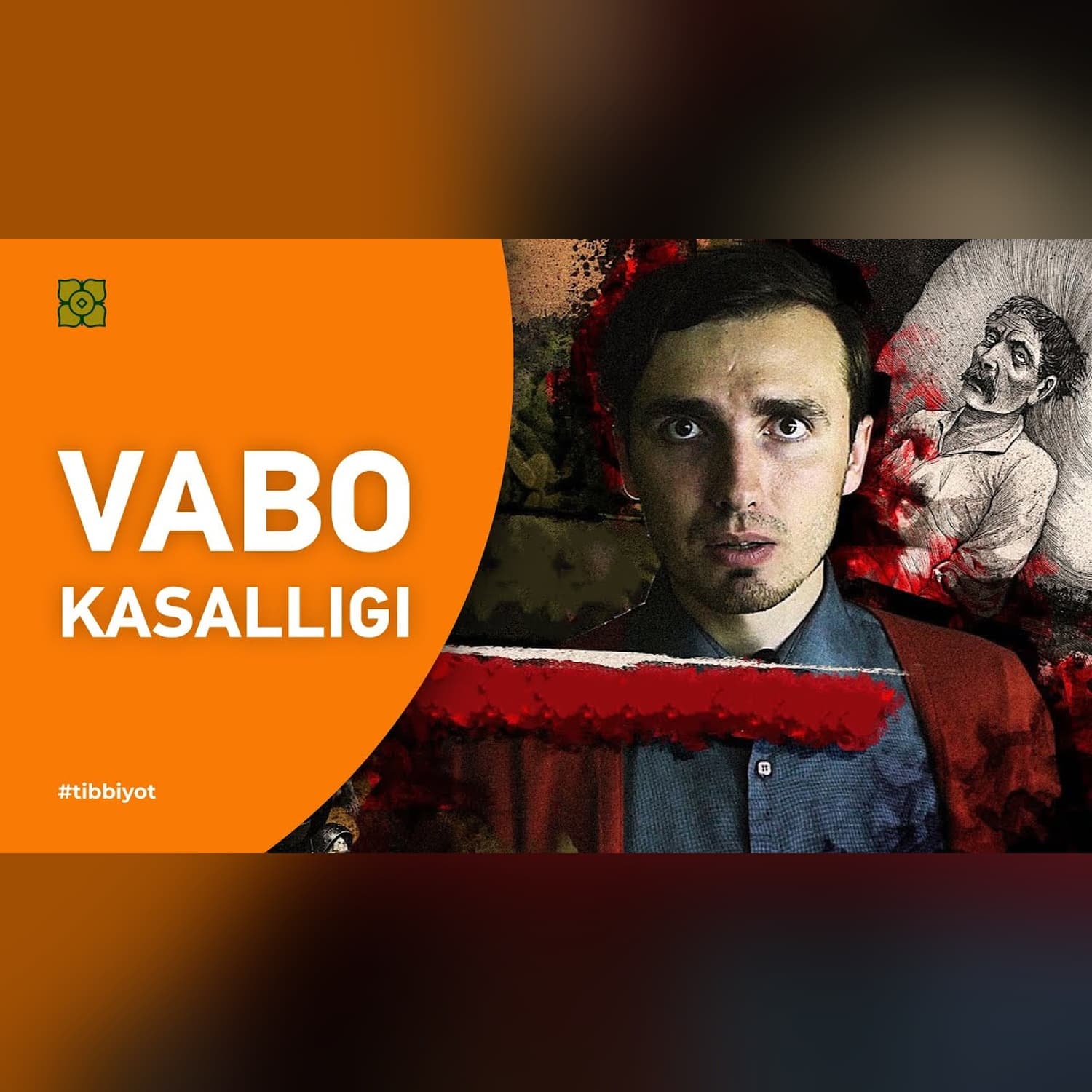 Vabo kasalligi. Tibbiyot tarixi | XURMO [Loony]